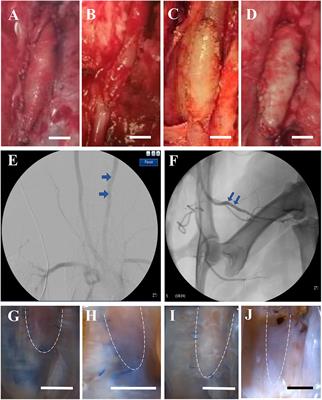 Novel Biomaterial for Artery Patch in Swine Model With High-Fat Diet